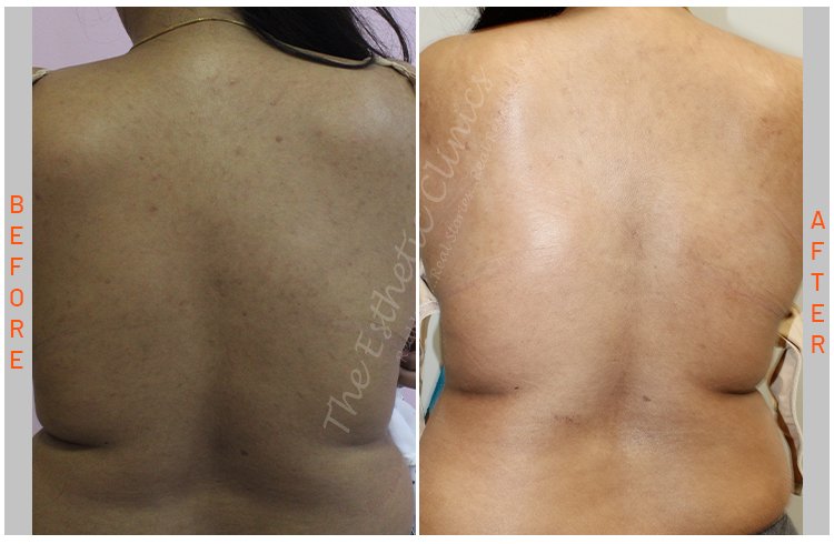 Esthetic Body Brite 
